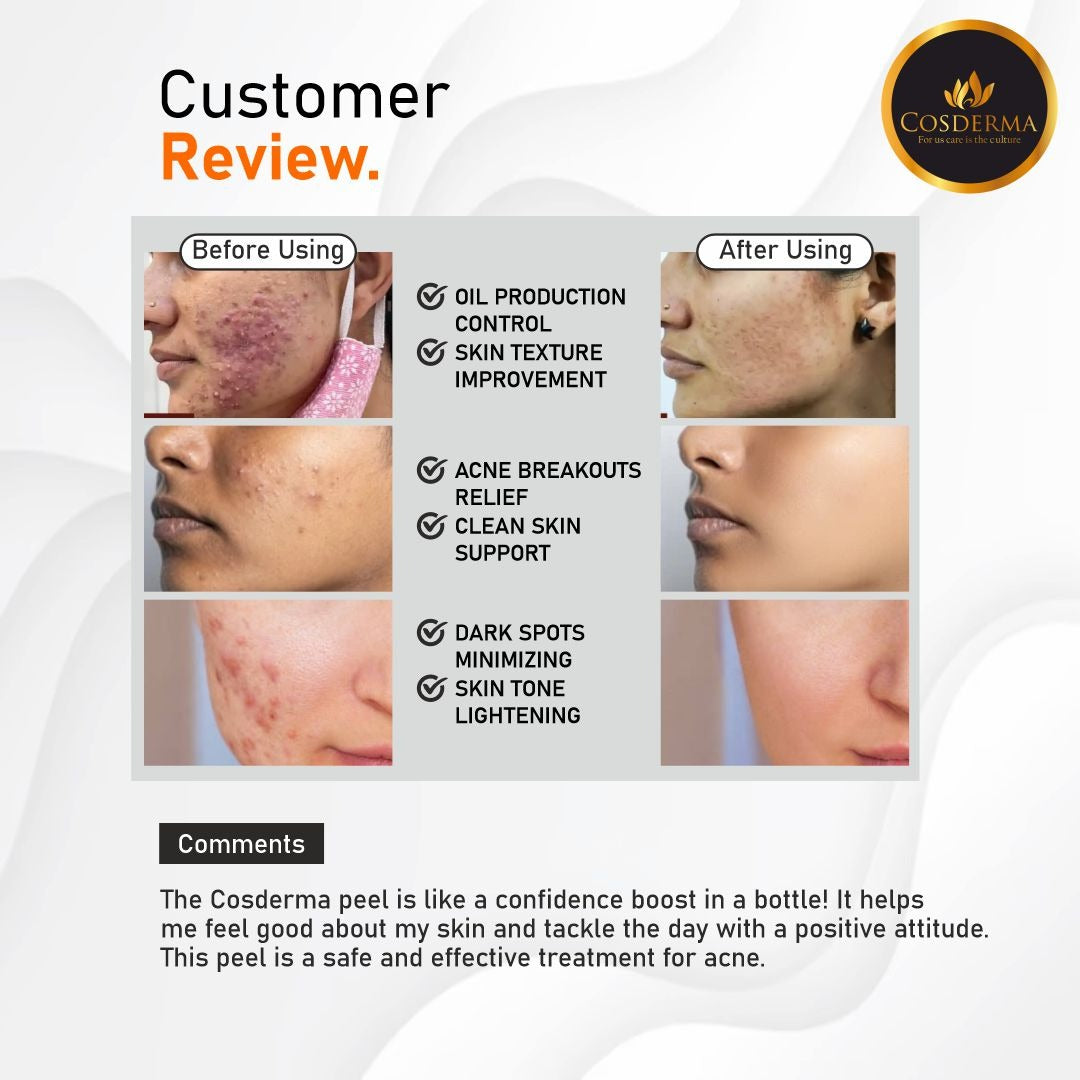 Cosderma Acne Act Peel 6