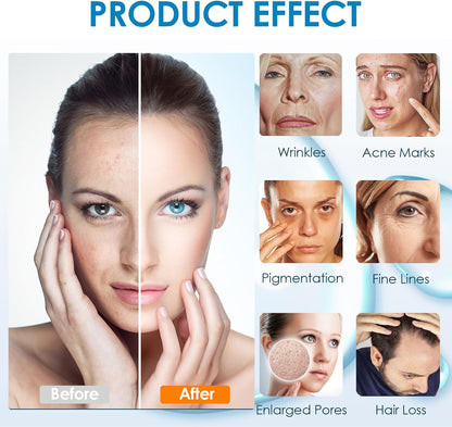 18-Needle Microneedling Cartridge for A11 Pen – Professional Needle Tip for Skin Rejuvenation, Acne Scars & Fine Lines