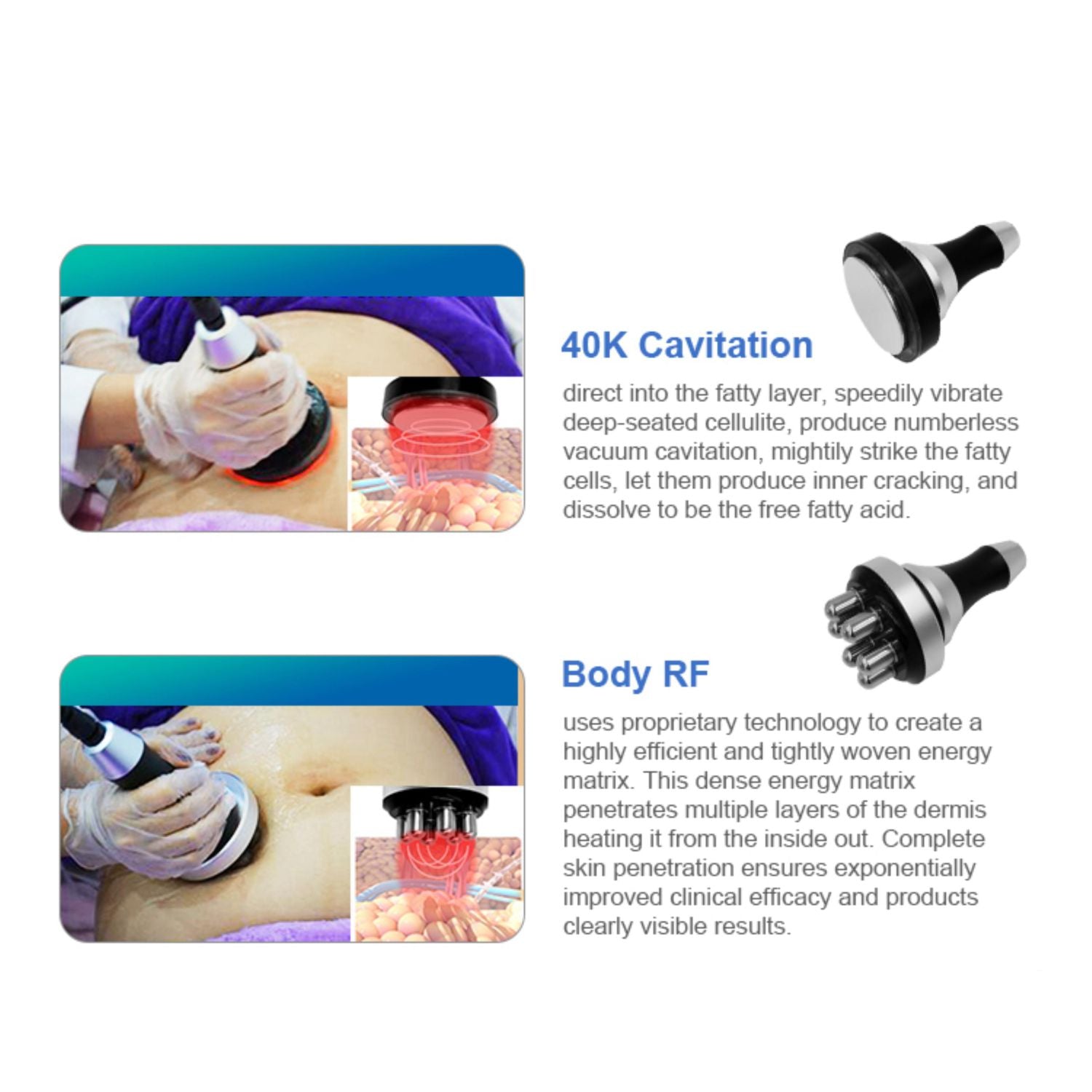 Cosderma 360° Angle Surrounding Cryolipolysis Slimming Machine creative 6