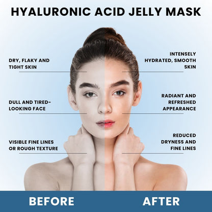 Cosderma Hyaluronic Acid Jelly Mask (10 x 35gm) – Deep Hydration & Skin Plumping Peel-Off Facial Mask