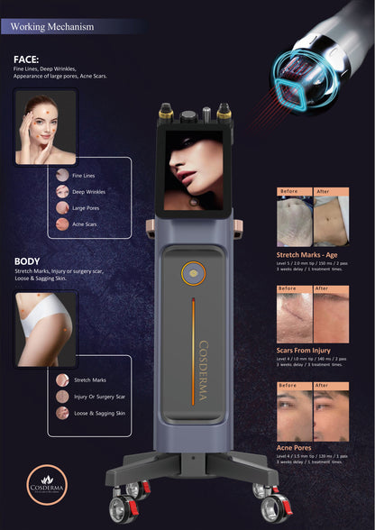 Cosderma Vacuum Microneedle Radio Frequency Machine | FDA Approved Vacuum MNRF Machine with Mono and Bipolar Mode | Micro Needling RF Machine