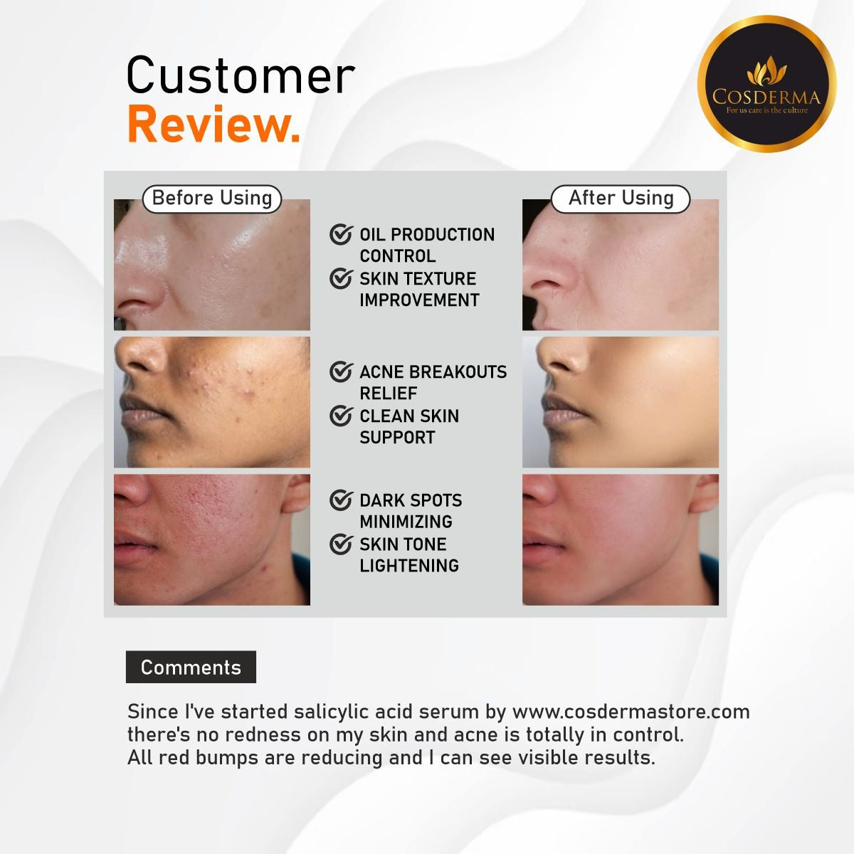 Cosderma Cosmelas Pro Peel | Effective for Melasma & Hyperpigmentation Treatment