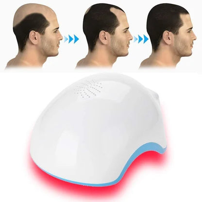 Cosderma Laser Hair Growth Helmet | Advanced Hair Rejuvenation Device